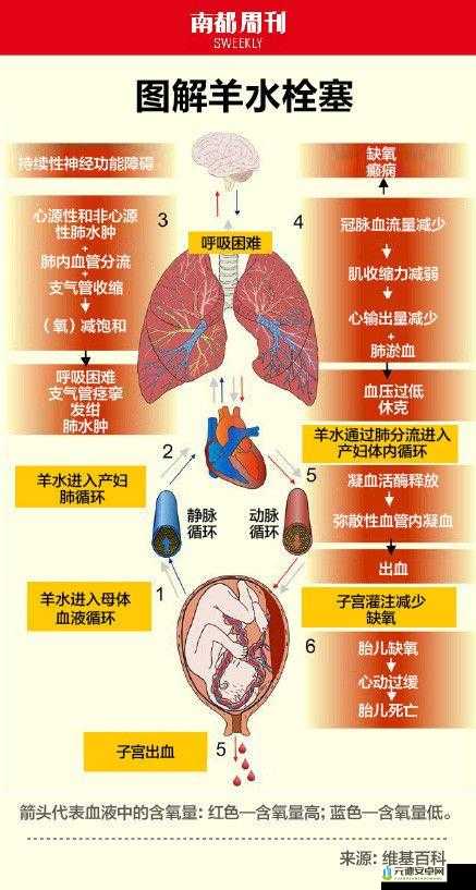 羊水栓塞：产妇死亡的隐形杀手