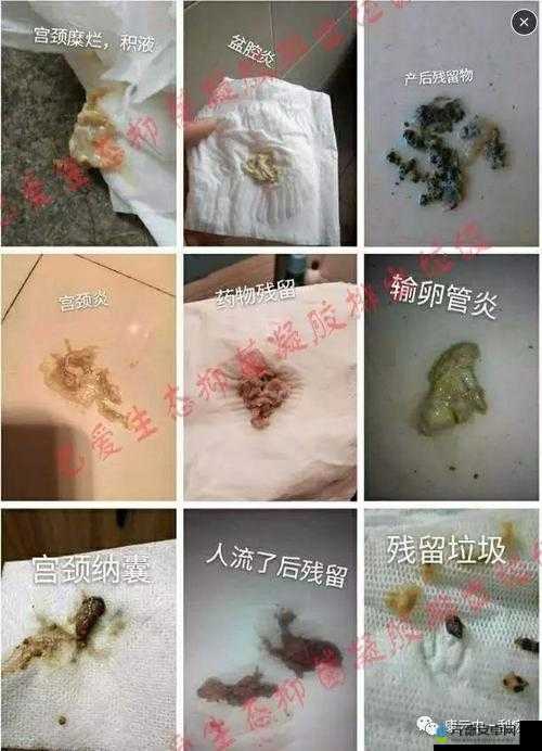 老中医李雪妮：排阴毒，真的有用吗